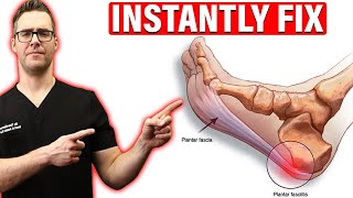 How To Cure Plantar Fasciitis FAST amp FOREVER Heel Pain amp Heel Spurs [upl. by Rep]