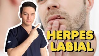 ¿Tienes Herpes Labial Descubre como tratarlo 🤕🩹 [upl. by Lennard984]