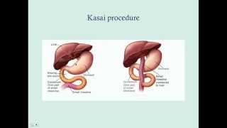 Newborn Direct Hyperbilirubinemia  CRASH Medical Review Series [upl. by Yelsew]