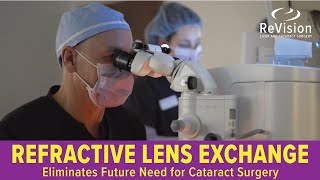 Refractive Lens Exchange [upl. by Eedia563]