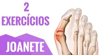 Como Cuidar da Joanete Aprenda 2 Exercícios [upl. by Ociredef]