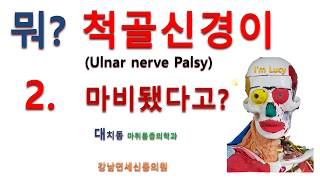 Ulnar nerve palsy 검사 및 치료 [upl. by Arded]