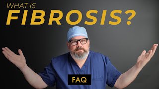 What Can You Do To Prevent FIBROSIS After Liposuction [upl. by Aerdnod]