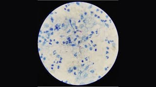 Sputum Test AFB StainingMLT PRACTICAL [upl. by Piero]