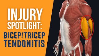 Injury Spotlight Bicep amp Tricep Tendonitis [upl. by Selby]