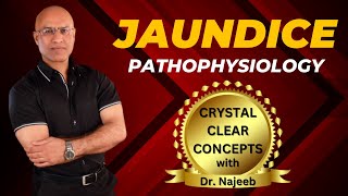 Pathophysiology Of Jaundice  Dr Najeeb Lectures [upl. by Amena]