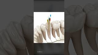 What To Expect During a Root Canal Is It Right For You [upl. by Cioban]