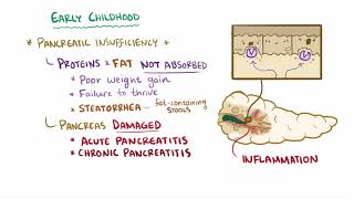 Cystic fibrosis causes symptoms diagnosis treatment amp pathology [upl. by Bittencourt364]