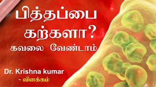 Causes of Gallbladder Stones Gallstones explanation In Tamil பித்தப்பை கற்கள் MIC Tamil [upl. by Ritch]