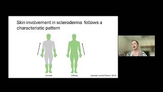 Blum Center Program Scleroderma  Symptoms Diagnosis and Treatments [upl. by Ailasor]