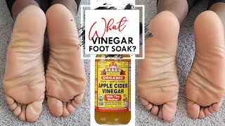 Does It work Apple Cider Vinegar Foot Soak A Natural Cure For Dry Feet [upl. by Irwin]