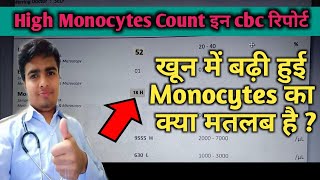 Monocytes High In Blood Test Monocytes In Hindi High Monocyte In Blood Cbc test [upl. by Limhaj]