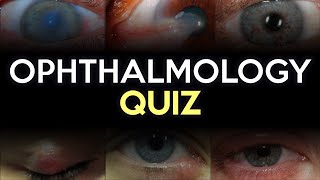 Ophthalmology Quiz [upl. by Akemot]