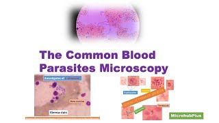 Common blood Parasites under the MicroscopePlasmodiumLeishmaniaMicrofilariaMalarial Parasites [upl. by Akemahc]