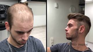 Hair Replacement fitting video David part 2 – Hair Inspira [upl. by Smada]