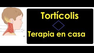 Tortícolis congénita tensión en cuello  Terapia en casa [upl. by Travax]