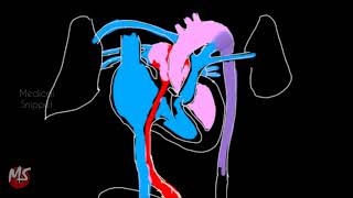 Fetal Circulation  Anatomy  Made easy  3 minutes [upl. by Ettevey]