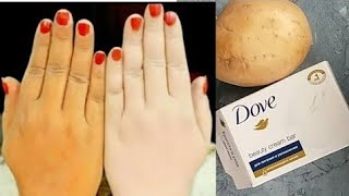 skin whitening potatoDove soap get fair skin in just 3 days [upl. by Karen]