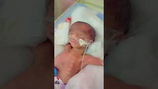 preterm baby cutebaby pray for baby [upl. by Leiad309]