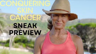 Conquering Skin Cancer⎜Sneak Preview ft Deborah Hutton [upl. by Naam380]