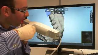 Intra Oral scanning with 3Shape TRIOS [upl. by Emili]