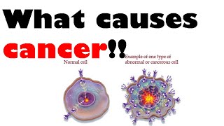 What causes cancer  causes of cancer in men and women [upl. by Sileray]