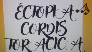 Ectopia Cordis Torácica [upl. by Eekcaj]