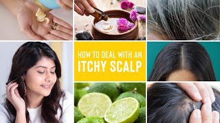 Scalp Care For Dry Scalp  How to treat a DRY FLAKY IRRITATED SCALP [upl. by Terriss]