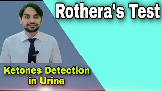 Rotheras Test  Ketone Bodies Detection in Urine [upl. by Warrenne677]