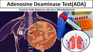 Adenosine Deaminase Test  Clear overview Tuberculosis ADAtestADAmlsmedilabacademy [upl. by Anelrad]