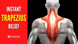 How to Fix Upper Trapezius Pain FOR GOOD [upl. by Yetty351]