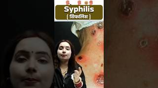 सिफलिस Syphilis रोग  Syphilis Causes Symptoms Treatment  STD disease Shorts Science PW [upl. by Anneuq]