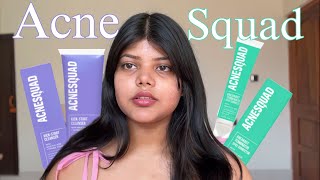 Unsponsered Acne Squad Review  Spot Corrector and Facewash Review [upl. by Rene678]