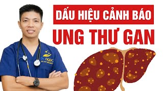 Không thể bỏ qua 6 dấu hiệu ung thư gan âm thầm phát triển trong bạn  Dr Ngọc [upl. by Harifaz]