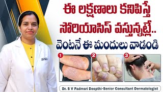 సోరియాసిస్ లక్షణాలు ఇవే  Psoriasis Skin Disease in Telugu  Psoriasis Symptoms  HRC Hospital [upl. by Verney557]