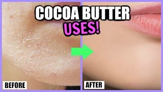 COCOA BUTTER BENEFITS FOR SKIN HAIR LIPS AND MORE │ 5 WAYS TO USE COCOA BUTTER [upl. by Hael363]