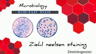 Ziehl Neelsen staining  Acid Fast staining microbiology 2ndyear BDS [upl. by Arlie]