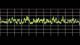 Stress  Rife Frequencies [upl. by Yarw993]