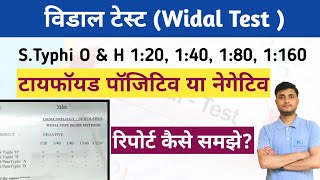 Widal Test in Hindi  टाइफाइड पॉजिटिव या नेगेटिव  Widal Test Report कैसे समझेMLTLabManual20 [upl. by Kehoe]