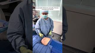 The Process of a Lipedema Knee Lift [upl. by Neellek]