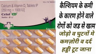 Celol D3 Plus Tablet Uses amp Dose  Calcium amp Vitamin D3  Healthy Bonnes Damage Nerve [upl. by Bores]