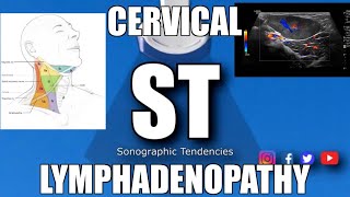 Sonoquickies  Cervical Lymphadenopathy [upl. by Eetnahc]