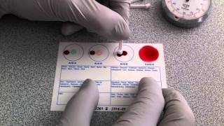 Blood Typing Using EldonCard HD [upl. by Amliw]