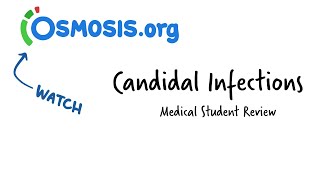 Candidal Infections Osmosis Study Video [upl. by Aneeb142]