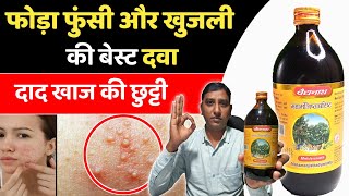 शरीर के सारे दाने फोड़े फुंसी होंगे जड़ से ठीक  Blood Infection Treatment  Mahamanjisthadyarishta [upl. by Aramahs]