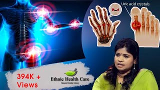 யூரிக் அமில அளவு குறைப்பது எப்படி  High Uric Acid  Mens Gout Arthritis  Dr Yoga Vidhya [upl. by Malachy370]