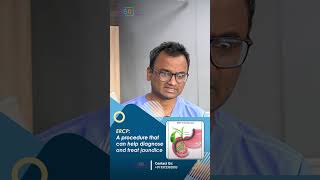 ERCP or PTBD Which is More Effective for Jaundice in Bile Duct Cancer  Dr Praveen Kammar [upl. by Telfer]