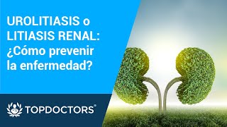 UROLITIASIS o LITIASIS RENAL ¿Cómo prevenir la enfermedad [upl. by Analise374]