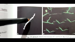 Syphilis Treponema Pallidum  Laboratory Diagnosis  NonTreponemal VDRLRPR and Treponemal test [upl. by Gonroff]