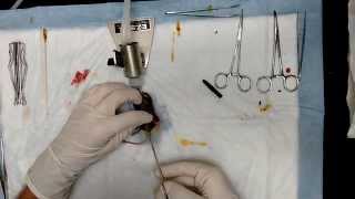 Orchidectomy surgery preformed by Dr Bowen [upl. by Townie309]